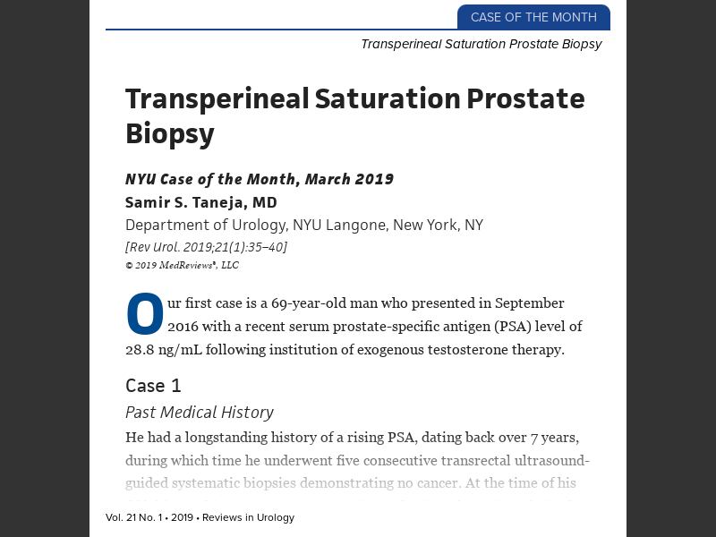 Transperineal Saturation Prostate Biopsy